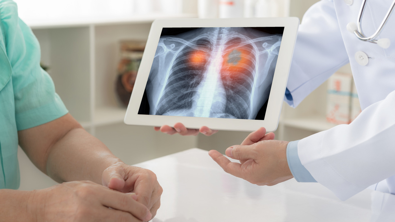 Best Doctor for COPD Treatment in Teynampet