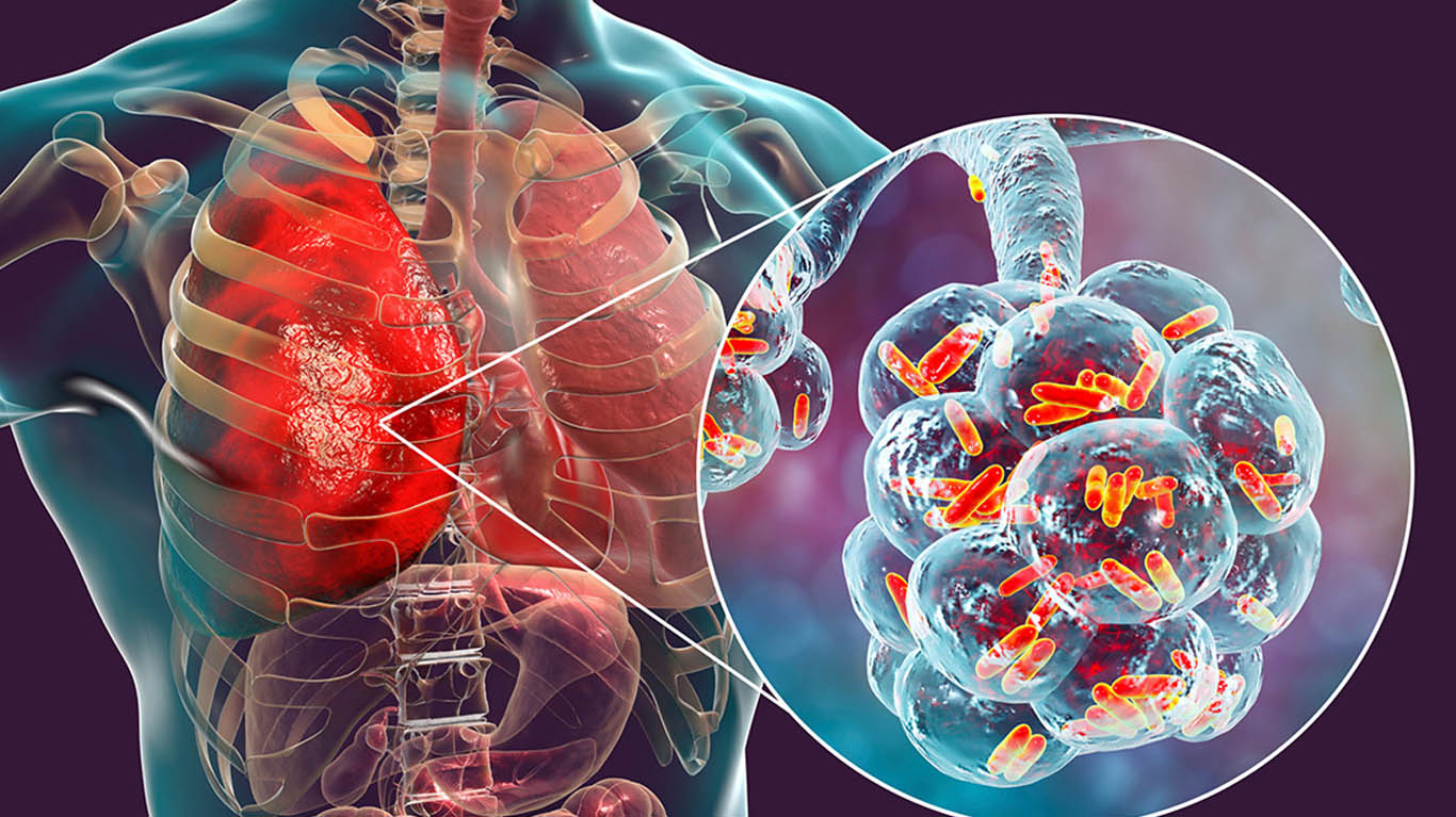 Best Doctor for Wheezing in Teynampet